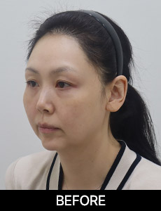 before 이미지
