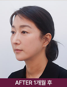 after 이미지