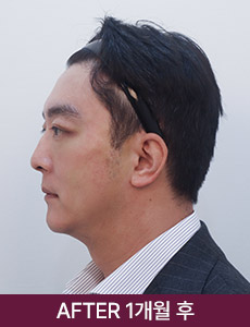 after 이미지