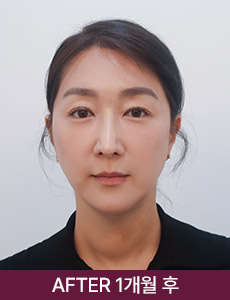 after 이미지